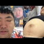 金バエさんの腹水と彼女がヤバい件 ぱるぱるニュース