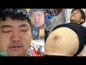 金バエさんの腹水と彼女がヤバい件 ぱるぱるニュース