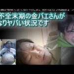 肝不全末期の金バエさんがかなりヤバい状況です よっさんニュース「あと3カ月くらいか・・・」「伝説になったね・・・」
